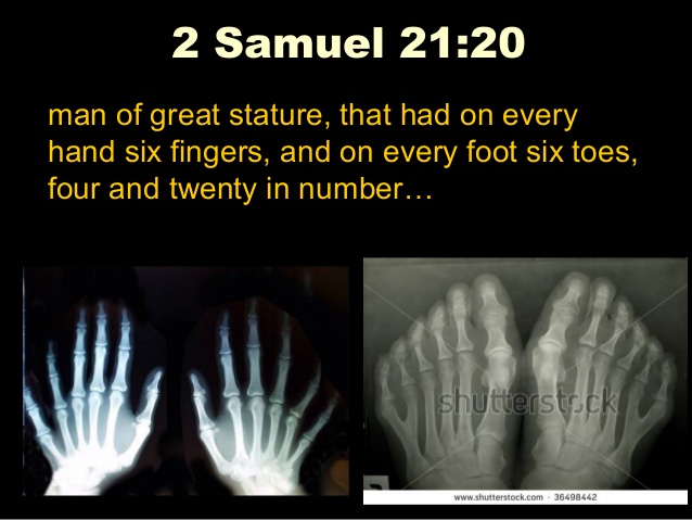 2 Samuel 21:20 - Six fingers and toes on giants, twenty digits total