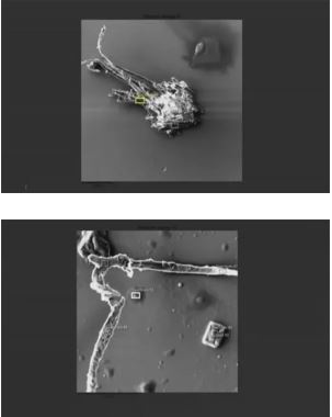 Covid-19 Moderna and Pfizer vaccine electromicroscope images by Dr. Nagase in 2022